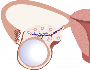 types of ovarian cyst - follicular