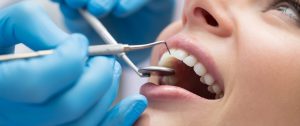 methods of dental cyst treatment