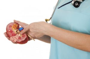 complex kidney cyst complications