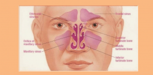 nose structure to understand the maxillary sinus retention cyst symptomatic and causes