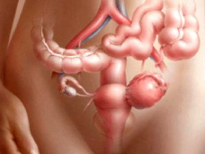 ovarian cancer symptoms and treatment