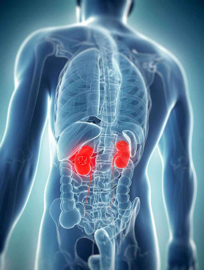 Simple kidney cyst disease characteristics. Ultrasound diagnostic and ...